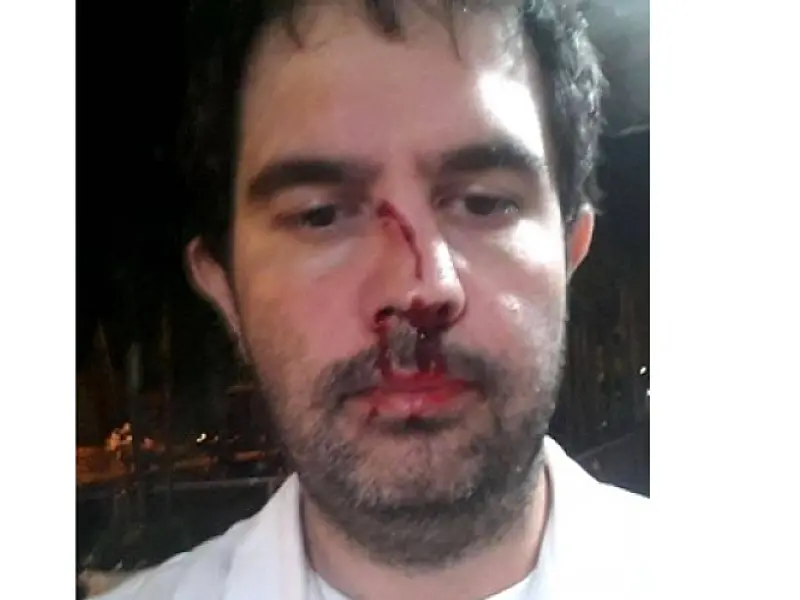 Médico de Nova Andradina é agredido por colega de profissão em hospital de Dourados