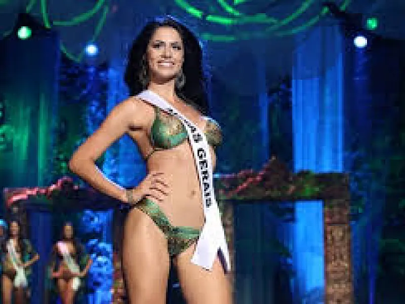 Com doença sem cura nos olhos, vice-miss Brasil pode ficar cega