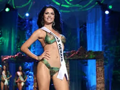 Com doença sem cura nos olhos, vice-miss Brasil pode ficar cega
