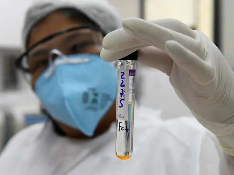 Com prática inovadora, Lacen passará a fazer sequenciamento genômico da turberculose em MS