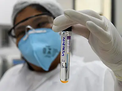 Com prática inovadora, Lacen passará a fazer sequenciamento genômico da turberculose em MS