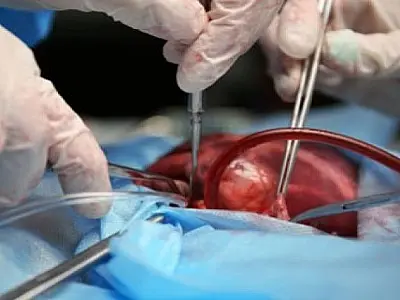 Setembro Verde: fila do transplante de órgãos tem 428 pessoas em MS, mas recusa de famílias chega a