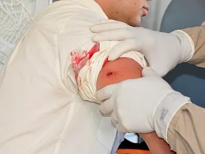 Funcionário dos Correios é baleado em tentativa de assalto no interior