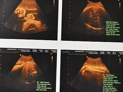Demora provoca morte de Bebê no Hospital Regional em Coxim