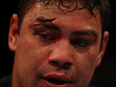 Lutador do UFC morre após sofrer infarto e ficar 13 dias internado