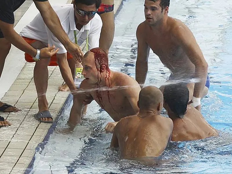 Saltador bate cabeça e deixa piscina sangrando em Mundial