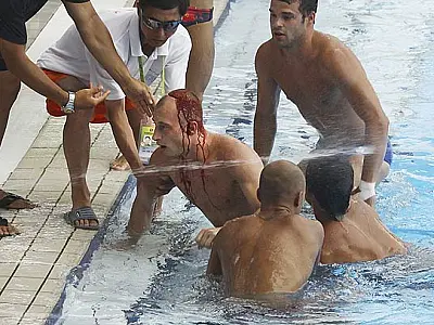 Saltador bate cabeça e deixa piscina sangrando em Mundial