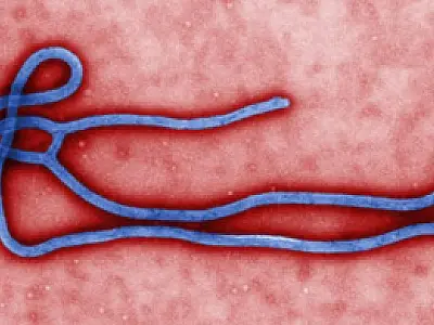 Secretaria de Saúde apresenta Protocolo de Vigilância de casos de Ebola