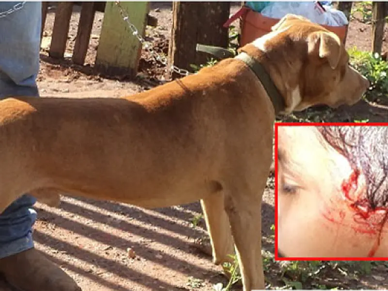 Pitbull ataca criança de cinco anos em Bonito