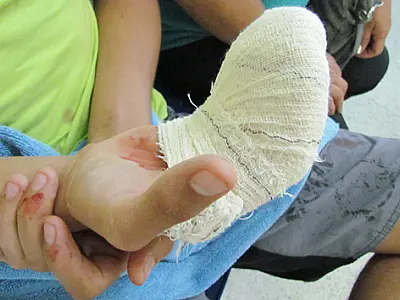 Durante futebol, adolescente prende aliança na trave e quase perde dedo