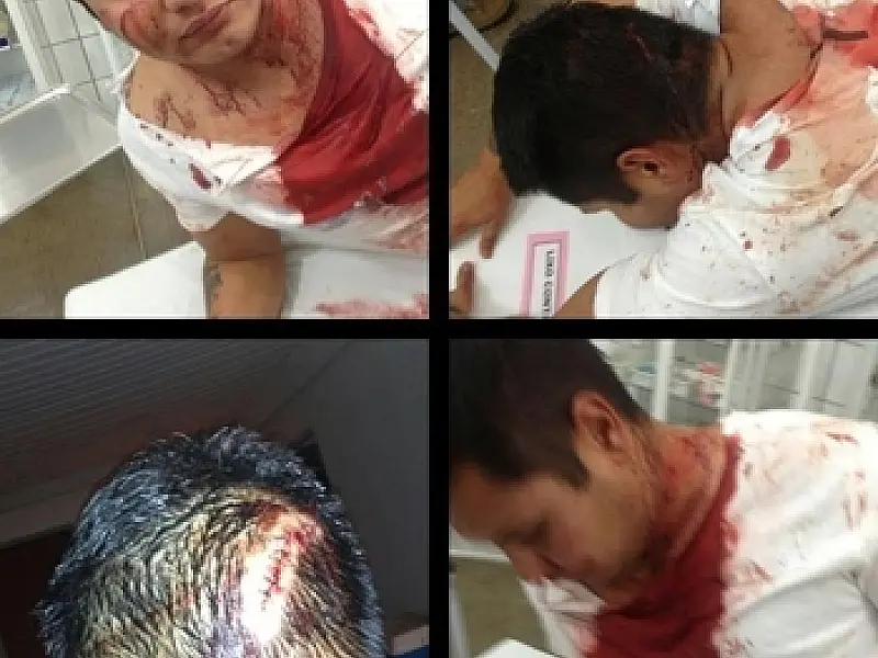 Jovem é agredido por três, polícia de São Gabriel investiga caso