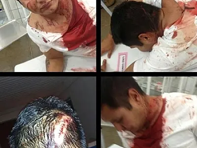 Jovem é agredido por três, polícia de São Gabriel investiga caso