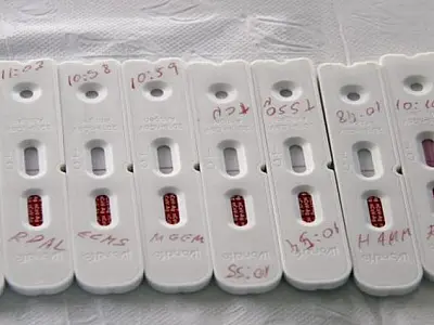 Boletim Covid desta quarta-feira registra 388 casos e 19 óbitos por Covid em MS
