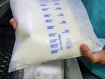 Hospital Regional inova e garante economia de R$ 1,6 milhão com projeto de Nutrição Parenteral Total