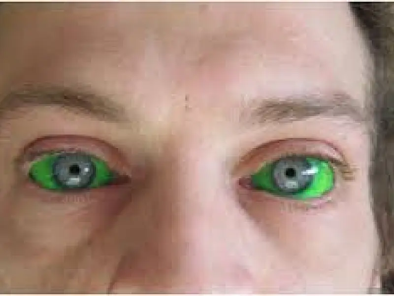 Tatuagem nos olhos poderá ser proibida no País