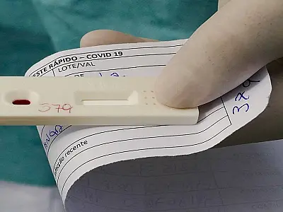 Saiba quais são os tipos testes existentes de Covid-19