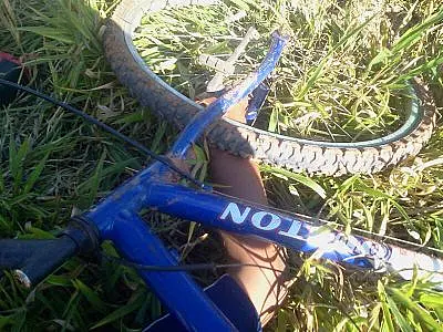 Menino de 7 anos prende perna entre garfo e roda de bicicleta