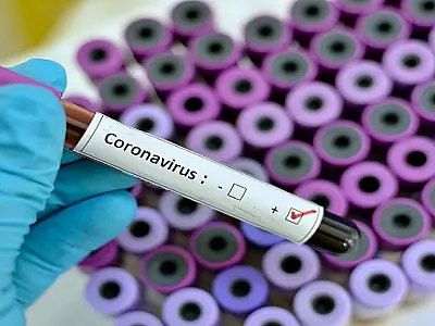 Mato Grosso do Sul registra 4.090 novos casos de Covid e 28 óbitos

