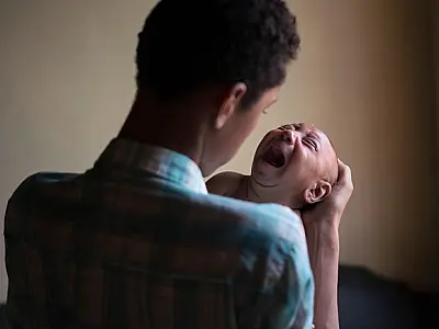 Cientistas acham mais uma evidência de ligação entre zika e microcefalia
