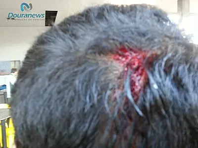 Carro atropela ciclista e foge sem prestar socorro em Dourados