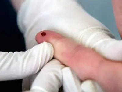 Notificação de HIV no Brasil passará a ser obrigatória