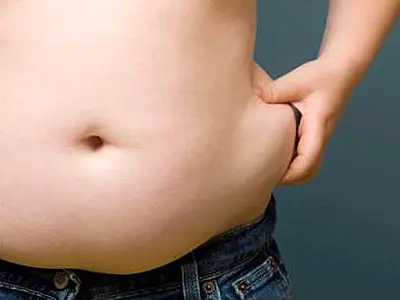Criança obesa tem 60% a mais de chance de sofrer bullying