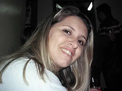 Por falta de aparelho no SUS cabeleireira organiza almoço beneficente para cirurgia