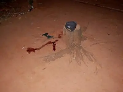 Homem é baleado na região da cabeça em Batayporã