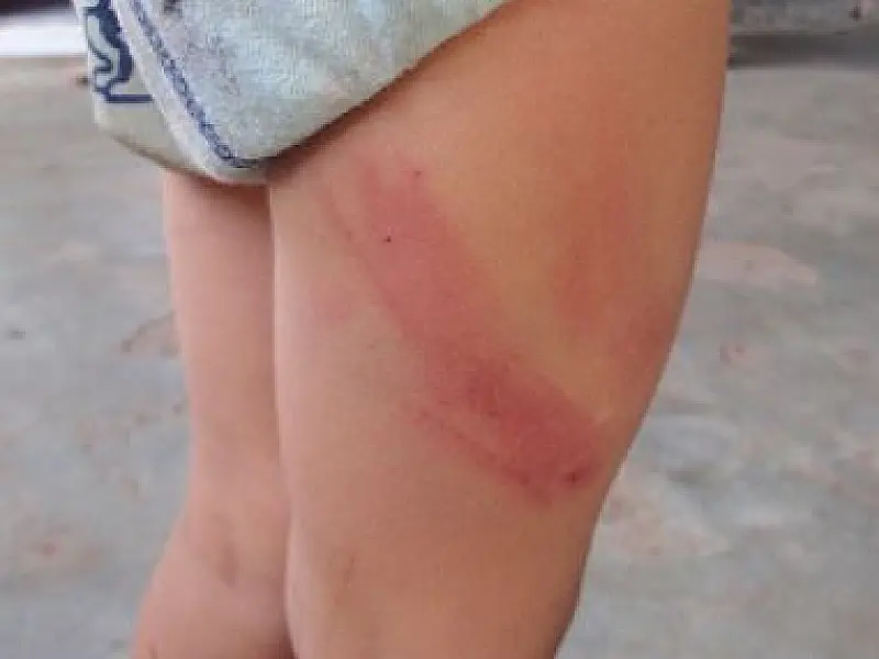 Criança de três anos é agredida pelo pai em Alcinópolis