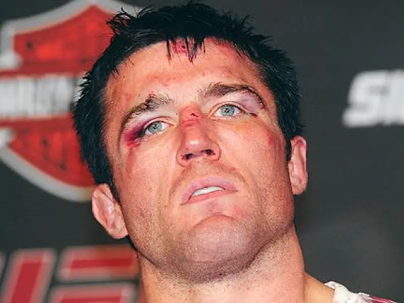 Segundo treinador, Chael Sonnen pode ter feito sua última luta no MMA
