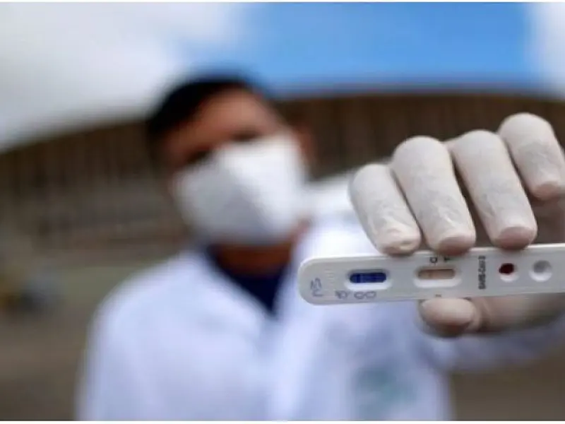 Com capacidade para mil testes diários, apenas 393 aguardam resultado no Lacen/MS