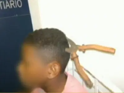 Menino atingido por alicate deixa CTI