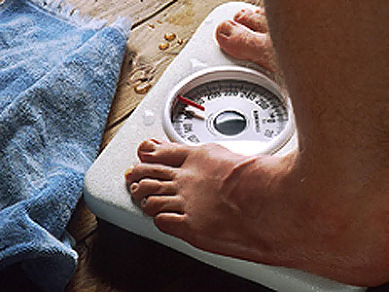 Obesidade não é sinônimo de doença, diz estudo