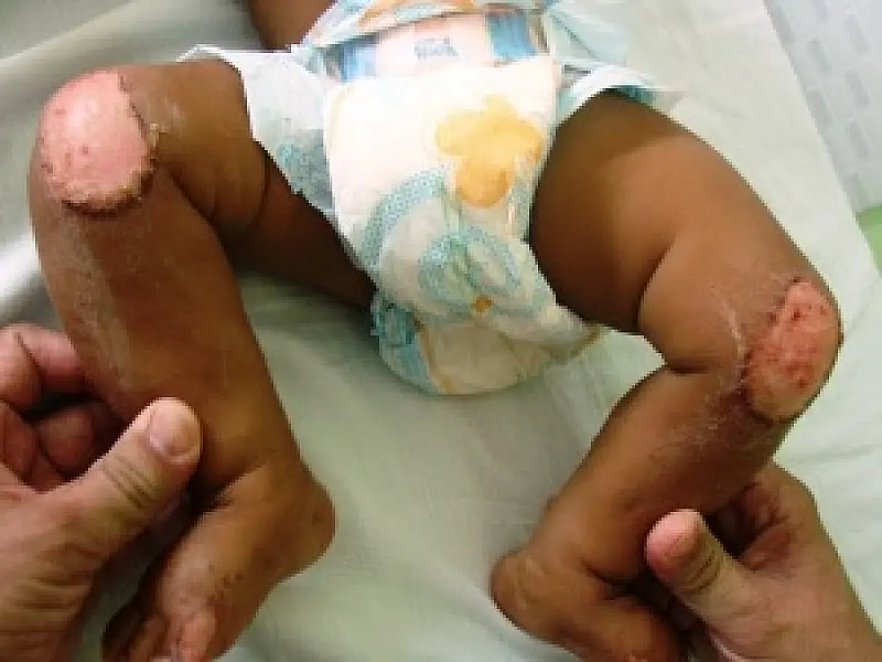 Mãe é acusada de queimar filho de seis meses em Ladário