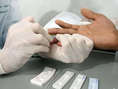 Com 1,4 mil casos de sífilis em 2018, prefeitura intensifica prevenção