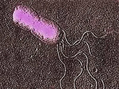 Pesquisadores estudam alterações do mapa de doenças infecciosas