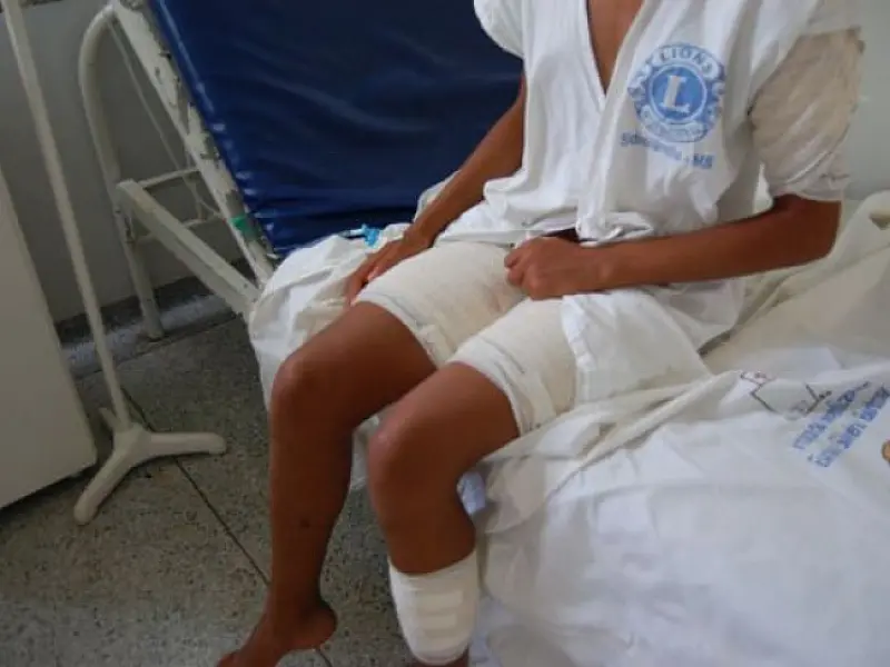 Menina de 13 anos tem ferimentos graves pelo corpo após ataque de cães