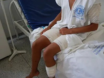 Menina de 13 anos tem ferimentos graves pelo corpo após ataque de cães