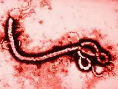 Deputado quer reforço nas fronteiras para evitar casos de ebola no País