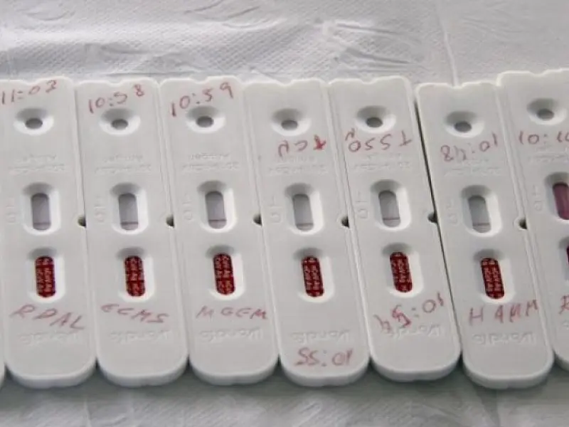 SES divulga boletim com 1,2 mil casos e 12 mortes por Covid nesta segunda-feira
