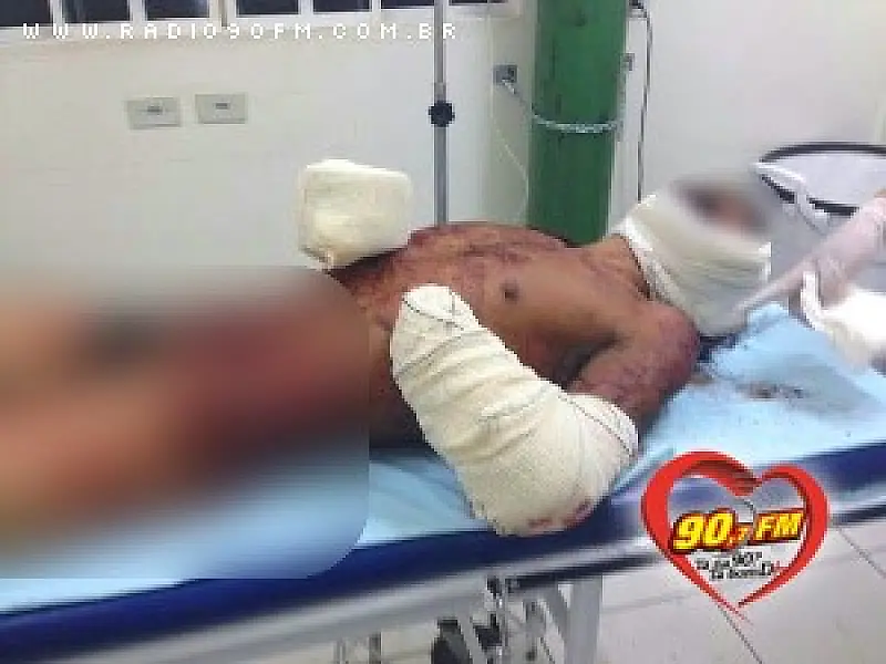 Homem tem mão arrancada com golpes de facão em Ribas do Rio Pardo