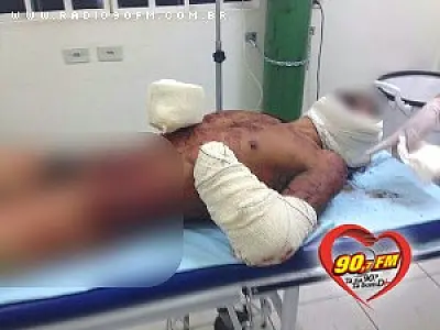 Homem tem mão arrancada com golpes de facão em Ribas do Rio Pardo