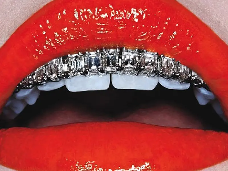 Grillz, as joias para dentes