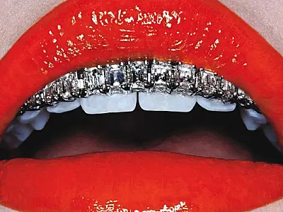 Grillz, as joias para dentes