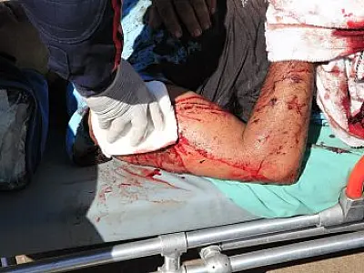 Caminhoneiro é alvejado com tiro durante tentativa de assalto na BR-163